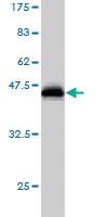 Anti-SPP1 Mouse Monoclonal Antibody [clone: 1E10]