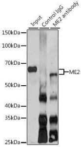 Immunoprecipitation analysis of 200µg extracts of SKOV3 cells using 3 µg of Anti-ME2 Antibody (A12382). This Western blot was performed on the immunoprecipitate using Anti-ME2 Antibody (A12382) at a dilution of 1:1000