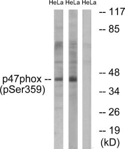 Western blot analysis of lysates from HeLa cells treated with nocodazole 1µg/ml 18h using Anti-p47 phox (phospho Ser359) Antibody. The right hand lane represents a negative control, where the antibody is blocked by the immunising peptide.