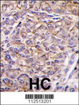 Anti-TAOK3 Rabbit Polyclonal Antibody (HRP (Horseradish Peroxidase))