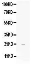 Anti-FGF19 Rabbit Polyclonal Antibody