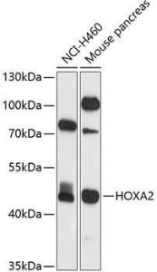 Western blot analysis of extracts of various cell lines, using Anti-HOXA2 Antibody (A12384) at 1:1000 dilution. The secondary Antibody was Goat Anti-Rabbit IgG H&L Antibody (HRP) at 1:10000 dilution. Lysates/proteins were present at 25 µg per lane