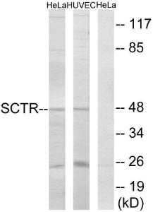 Western blot analysis of lysates from HeLa and HUVEC cells using Anti-SCTR Antibody. The right hand lane represents a negative control, where the antibody is blocked by the immunising peptide