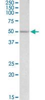 Anti-POU2F3 Goat Polyclonal Antibody