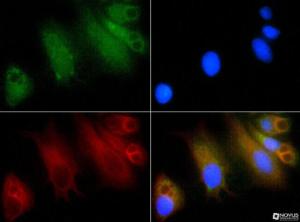 Anti-GLI1 Rabbit Polyclonal Antibody