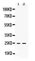 Anti-FGF19 Rabbit Polyclonal Antibody