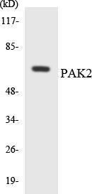 Western blot analysis of the lysates from COLO205 cells using Anti-PAK2 Antibody