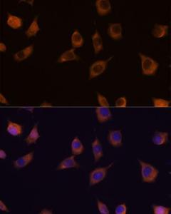 Immunofluorescence analysis of L929 cells using Anti-PHLPP2 Antibody (A305647) at a dilution of 1:100 DAPI was used to stain the cell nuclei (blue)