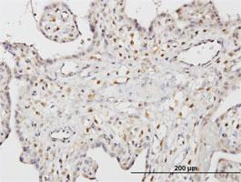 Anti-STK33 Mouse Monoclonal Antibody [clone: 3F10]