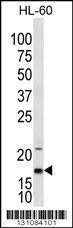 Anti-IL36RN Rabbit Polyclonal Antibody (AP (Alkaline Phosphatase))