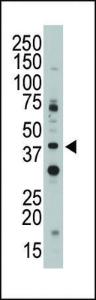 Anti-CD33 Rabbit Polyclonal Antibody (FITC (Fluorescein Isothiocyanate))