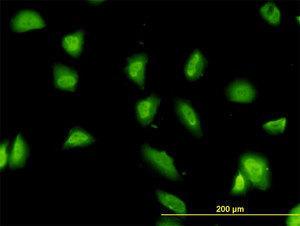 Anti-G3BP1 Mouse monoclonal antibody [clone: 2F3]