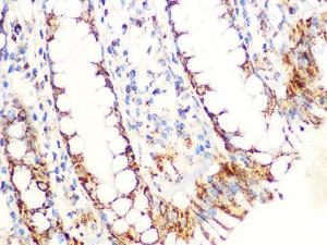 Immunohistochemistry analysis of paraffin-embedded human colon tissue using Anti-Aconitase 2 Antibody [ARC1072] (A306968) at a dilution of 1:100 (40x lens). Perform microwave antigen retrieval with 10 mM PBS buffer pH 7.2 before commencing with IHC staining protocol.