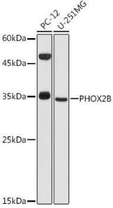 Anti-PHOX2B antibody