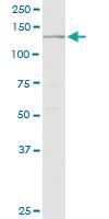 Anti-PLCG2 Rabbit Polyclonal Antibody