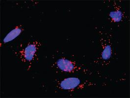 Anti-MDM2 Antibody Pair