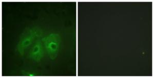 Immunofluorescence analysis of HeLa cells using Anti-p47 phox (phospho Ser359) Antibody. The right hand panel represents a negative control, where the antibody was pre-incubated with the immunising peptide.