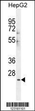 Anti-CES1P1 Rabbit Polyclonal Antibody (Biotin)