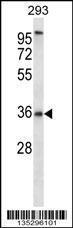 Anti-P2RY6 Rabbit Polyclonal Antibody (FITC (Fluorescein Isothiocyanate))