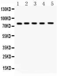 Anti-FSHR Rabbit Polyclonal Antibody