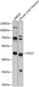 Western blot analysis of extracts of various cell lines, using Anti-STK25 Antibody (A12390) at 1:1,000 dilution The secondary antibody was Goat Anti-Rabbit IgG H&L Antibody (HRP) at 1:10,000 dilution Lysates/proteins were present at 25 µg per lane