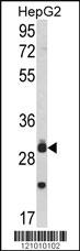 Anti-MYD88 Rabbit Polyclonal Antibody