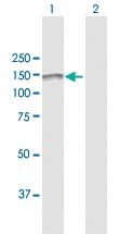 Anti-PLCG2 Rabbit Polyclonal Antibody