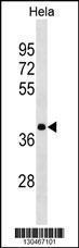 Anti-HNRNPA3 Rabbit Polyclonal Antibody