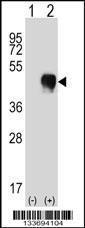 Anti-FCGR2A Rabbit Polyclonal Antibody (AP (Alkaline Phosphatase))