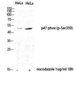 Western blot analysis of HeLa nocodazole 1µg/ml 18h cells using Anti-p47 phox (phospho Ser359) Antibody