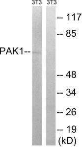 Western blot analysis of lysates from NIH/3T3 cells, treated with UV 15' using Anti-PAK1 Antibody. The right hand lane represents a negative control, where the antibody is blocked by the immunising peptide