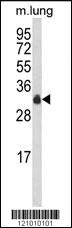 Anti-HOXD10 Rabbit Polyclonal Antibody