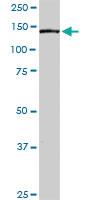 Anti-PLCG2 Rabbit Polyclonal Antibody