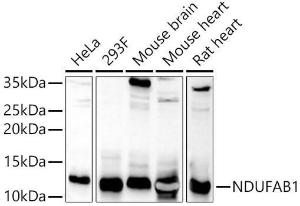 Western blot analysis of extracts of various cell lines, using Anti-NDUFAB1 Antibody (A308107) at 1:900 dilution The secondary antibody was Goat Anti-Rabbit IgG H&L Antibody (HRP) at 1:10,000 dilution Lysates/proteins were present at 25 µg per lane