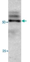 Anti-ATG4C Rabbit Polyclonal Antibody