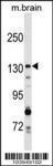 Anti-GAK Rabbit polyclonal antibody