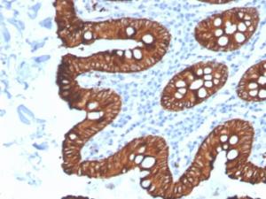 Anti-Cytokeratin 8 antibody