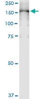 Anti-PLCG2 Rabbit Polyclonal Antibody