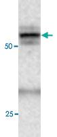 Anti-ATG4C Rabbit Polyclonal Antibody