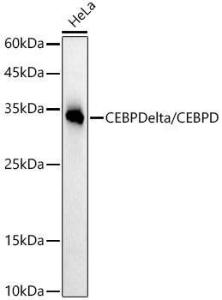 Western blot analysis of HeLa, using Anti-CEBP Delta / CEBPD Antibody [ARC52980] (A308108) at 1:20000 dilution