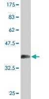 Anti-SEC63 Mouse Monoclonal Antibody [clone: 1A8]