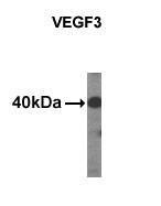 Anti-VEGFC Mouse Monoclonal Antibody (FITC (Fluorescein Isothiocyanate)) [clone: 30AT1174.77]