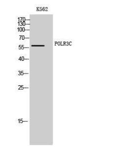 Western blot analysis of K562 cells using Anti-RPC3 Antibody