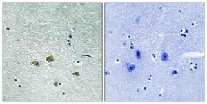 Immunohistochemical analysis of paraffin-embedded human brain tissue using Anti-PAK1 Antibody. The right hand panel represents a negative control, where the antibody was pre-incubated with the immunising peptide