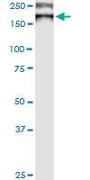 Anti-ATP7B Mouse Monoclonal Antibody [clone: 3E10]