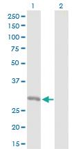 Anti-ORC6 Rabbit Polyclonal Antibody