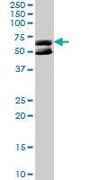 Anti-KLHDC4 Rabbit Polyclonal Antibody