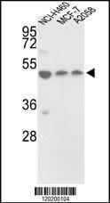 Anti-PDIA6 Rabbit Polyclonal Antibody