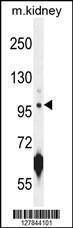 Anti-CARNS1 Rabbit Polyclonal Antibody (FITC (Fluorescein Isothiocyanate))