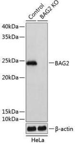 Western blot analysis of extracts from normal (control) and BAG2 knockout (KO) HeLa cells, using Anti-BAG2 Antibody (A306970) at 1:1,000 dilution The secondary antibody was Goat Anti-Rabbit IgG H&L Antibody (HRP) at 1:10,000 dilution Lysates/proteins were present at 25 µg per lane